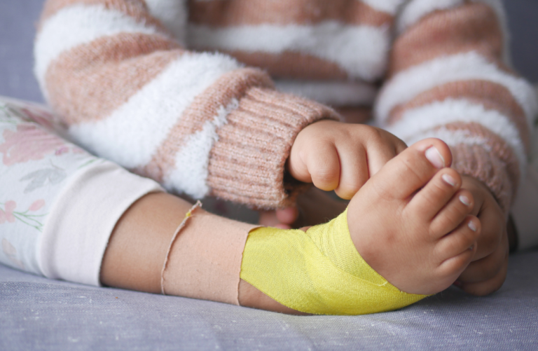 What Is Kinesio-Taping?